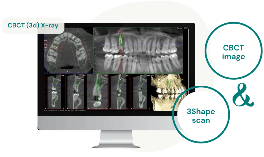 Immagine cbct e scansione debtale 3shape-dr-goran-slivar-centro impianti dentali Immagine cbct e scansione debtale 3shape-dr-goran-slivar-centro impianti dentali