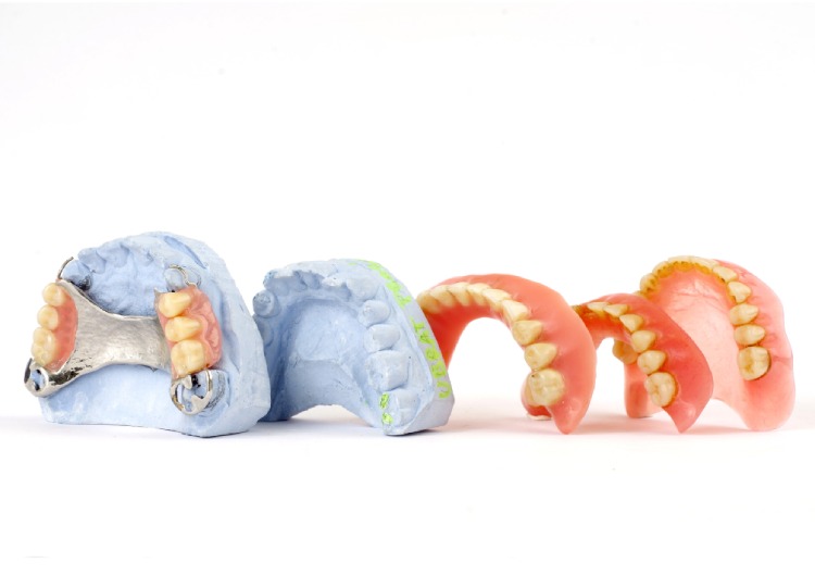 protesi dentaria - clinica dentale croata - offerta top protesi dentaria - clinica dentale croata - offerta top