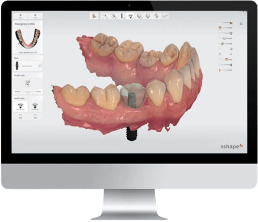 3shape model computer