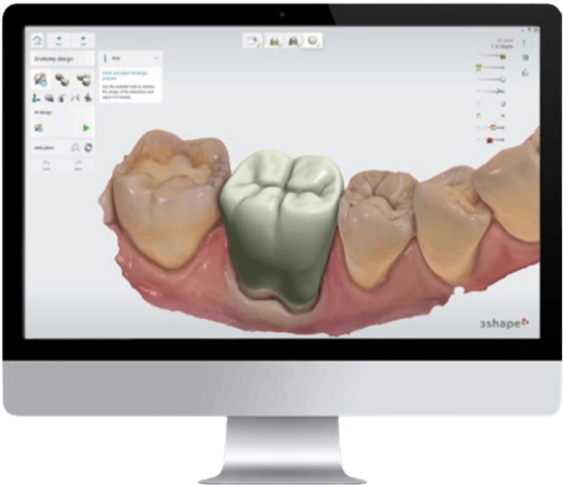 3shape render dental implants center dr goran slivar