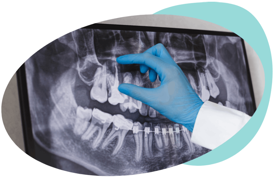 Zahnärztliche Radiologie-Dental-Implants-center-Kroatien